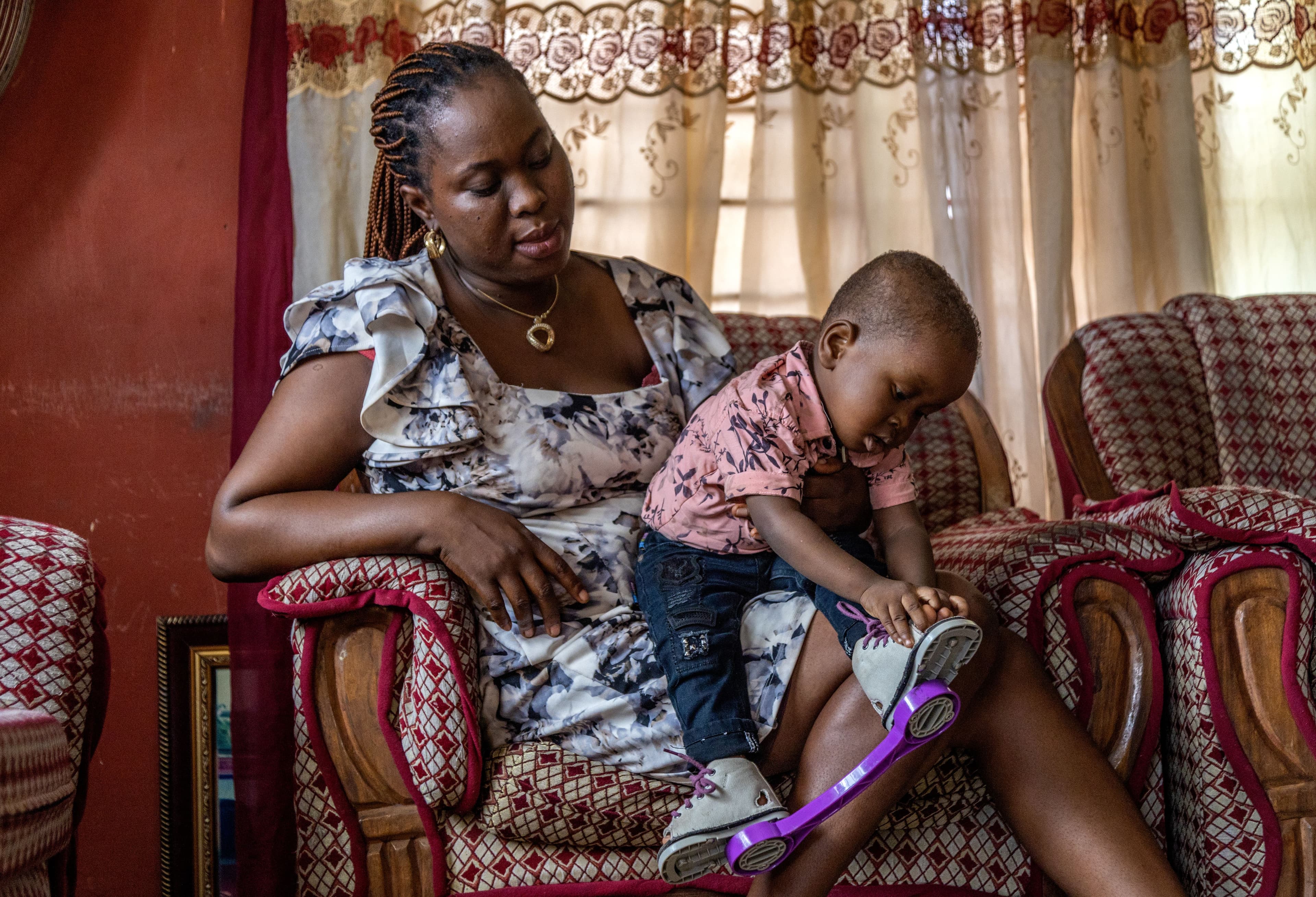 Mother with baby boy in clubfoot treatment brace.