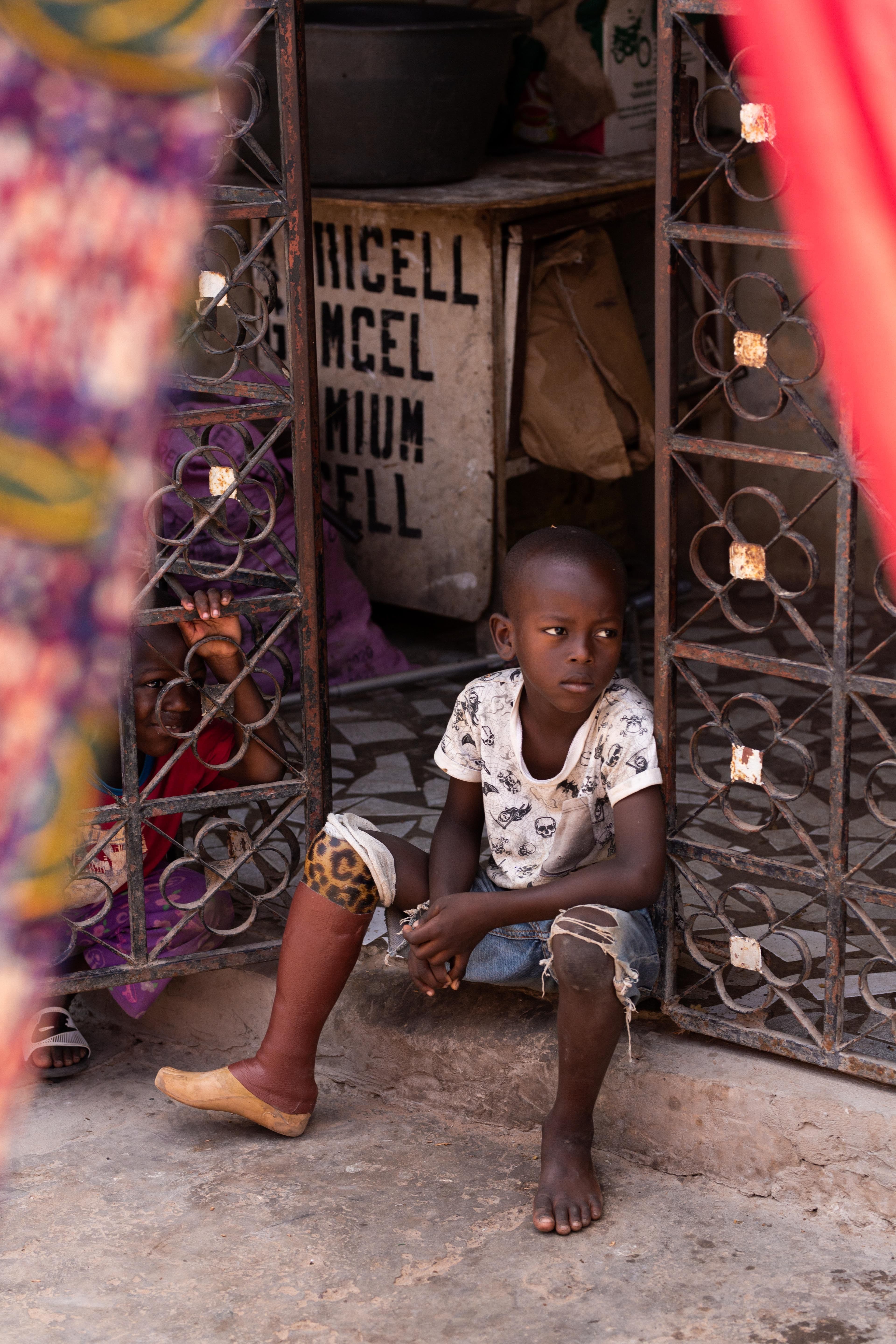 amputee, prosthetic, Ghana, project 42